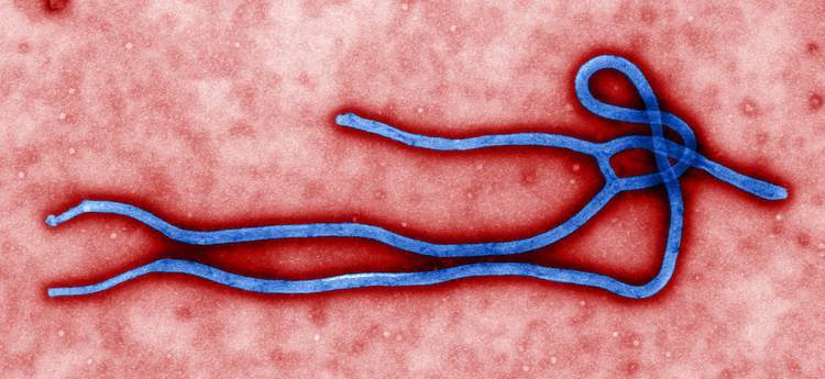 ultrastructural-morphology-displayed-by-an-ebola-virus-virion_1__1_