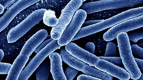 _53234379_escherichia-coli_1_